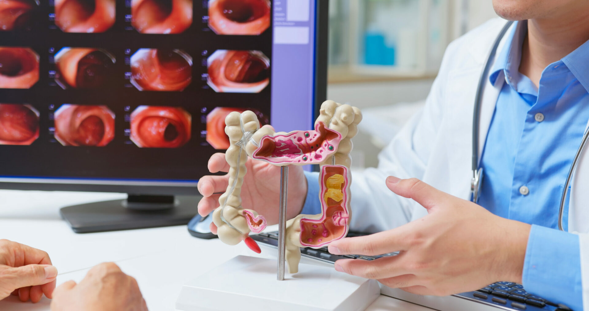 Consultation chirurgicale : explication anatomie colorectale