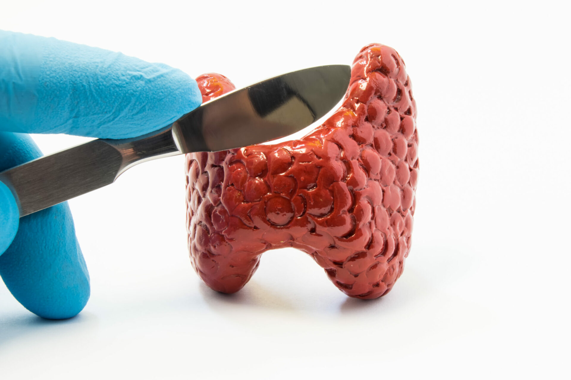 Chirurgie de la thyroïde et des parathyroïdes — site dédié chirurgie-thyroide-paris.fr